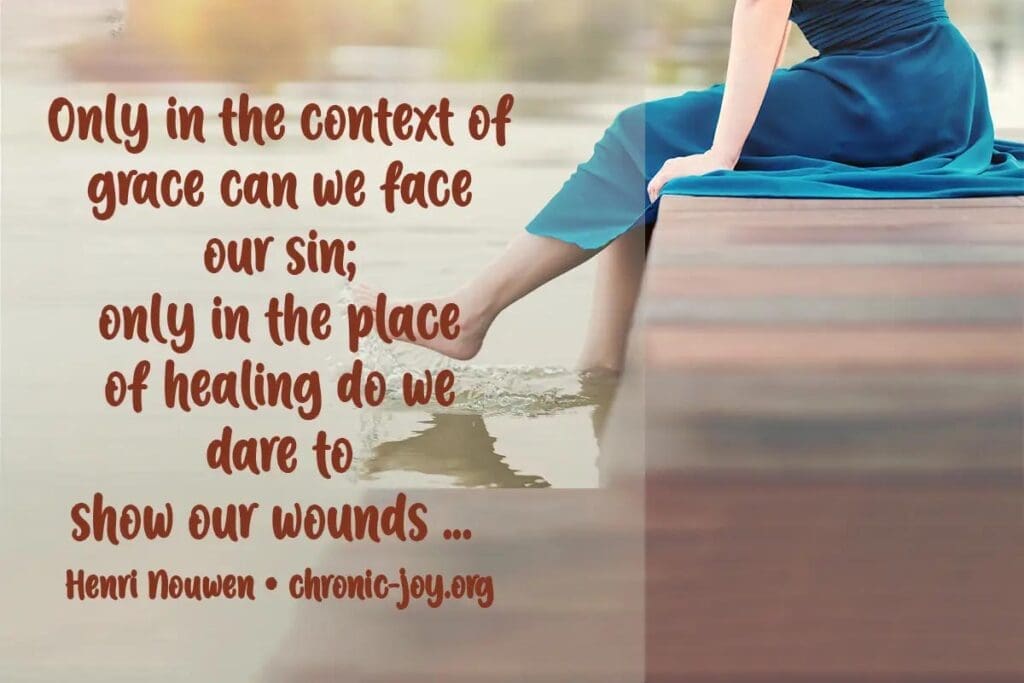 "Only in the context of grace can we face our sin; only in the place of healing do we dare to show our wounds ... " Henri Nouwen